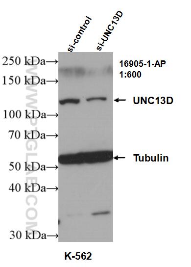 Western Blot (WB) analysis of K-562 cells using UNC13D/Munc13-4 Polyclonal antibody (16905-1-AP)
