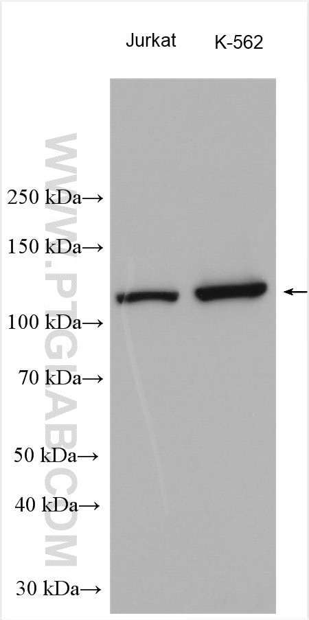 Western Blot (WB) analysis of various lysates using UNC13D/Munc13-4 Polyclonal antibody (16905-1-AP)