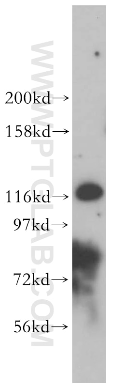 UNC13D/Munc13-4 Polyclonal antibody