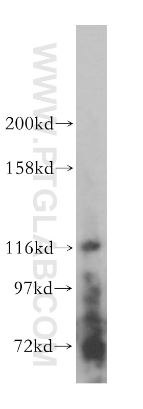 Western Blot (WB) analysis of human placenta tissue using UNC13D/Munc13-4 Polyclonal antibody (16905-1-AP)