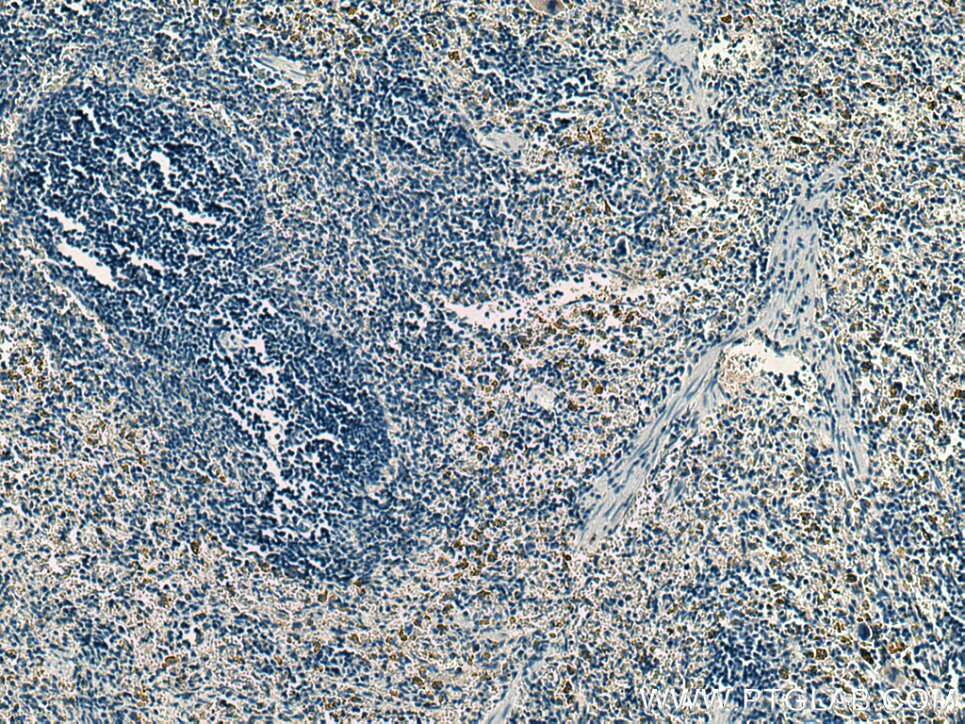 Immunohistochemistry (IHC) staining of rat spleen tissue using UNC13D Monoclonal antibody (67193-1-Ig)