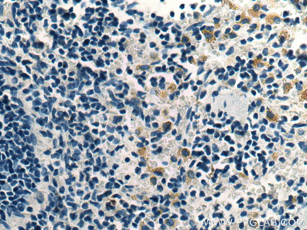 Immunohistochemistry (IHC) staining of rat spleen tissue using UNC13D Monoclonal antibody (67193-1-Ig)
