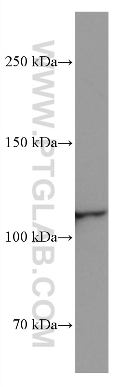 WB analysis of RAW 264.7 using 67193-1-Ig