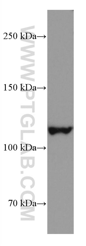 Western Blot (WB) analysis of rat spleen tissue using UNC13D Monoclonal antibody (67193-1-Ig)