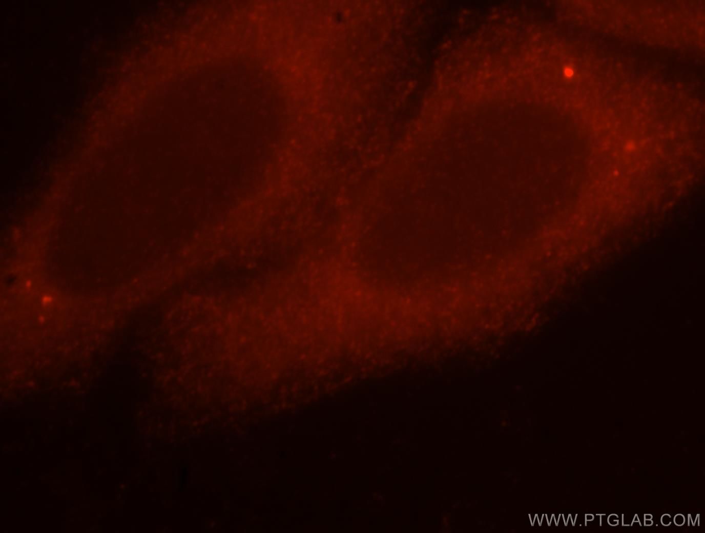 Immunofluorescence (IF) / fluorescent staining of HepG2 cells using UNC45A Polyclonal antibody (15479-1-AP)
