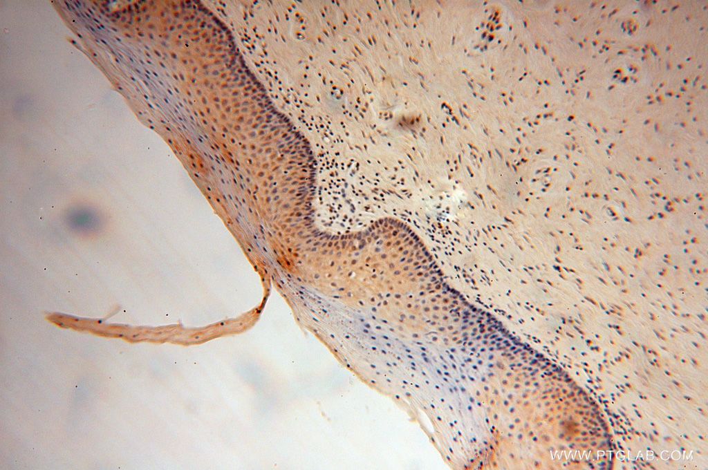 Immunohistochemistry (IHC) staining of human cervix tissue using UNC45A Polyclonal antibody (15479-1-AP)