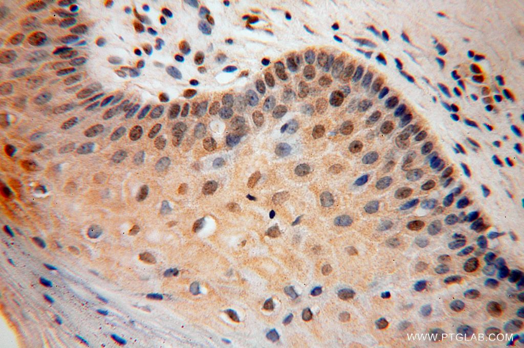 Immunohistochemistry (IHC) staining of human cervix tissue using UNC45A Polyclonal antibody (15479-1-AP)