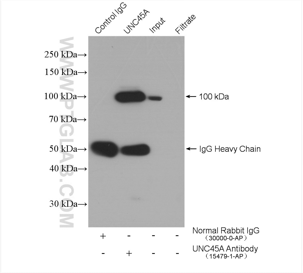 Immunoprecipitation (IP) experiment of HeLa cells using UNC45A Polyclonal antibody (15479-1-AP)