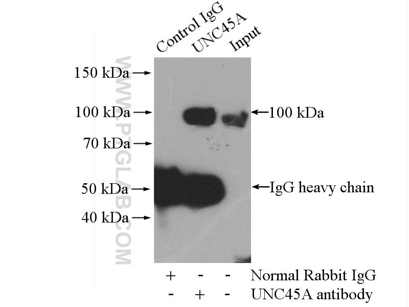 Immunoprecipitation (IP) experiment of HeLa cells using UNC45A Polyclonal antibody (15479-1-AP)