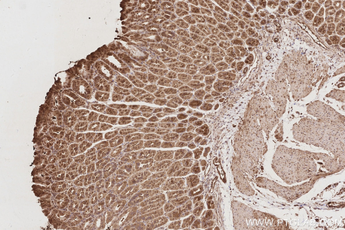 Immunohistochemistry (IHC) staining of mouse stomach tissue using UNC45A Polyclonal antibody (19564-1-AP)