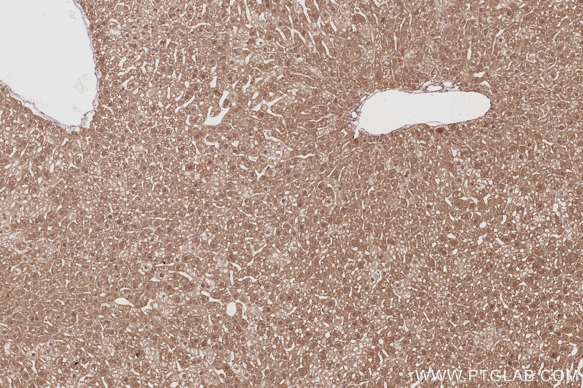 Immunohistochemistry (IHC) staining of mouse liver tissue using UNC45A Polyclonal antibody (19564-1-AP)