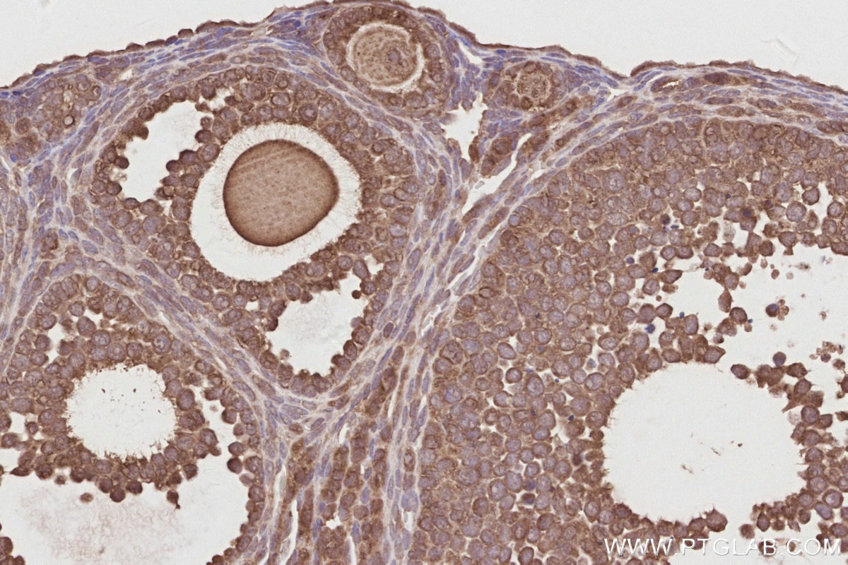 Immunohistochemistry (IHC) staining of mouse ovary tissue using UNC45A Polyclonal antibody (19564-1-AP)