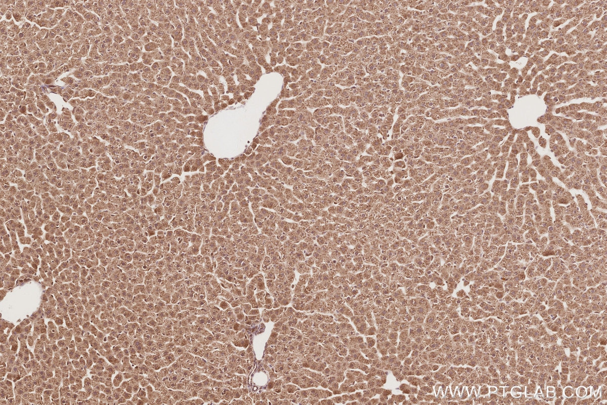 Immunohistochemistry (IHC) staining of rat liver tissue using UNC45A Polyclonal antibody (19564-1-AP)