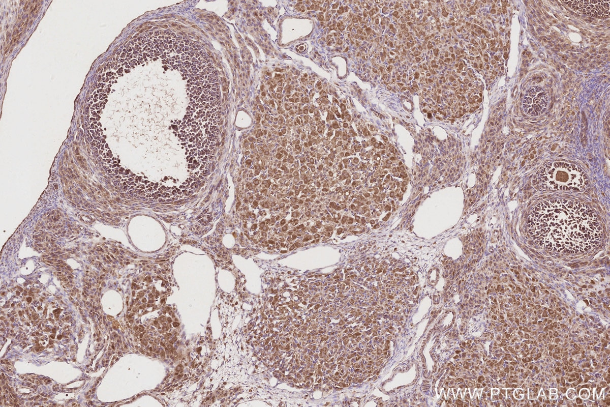 Immunohistochemistry (IHC) staining of rat ovary tissue using UNC45A Polyclonal antibody (19564-1-AP)