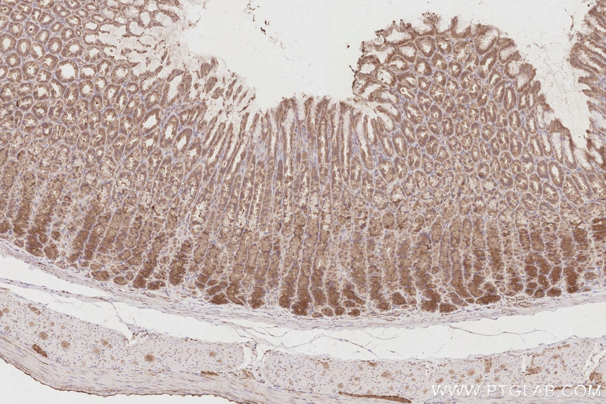 Immunohistochemistry (IHC) staining of rat stomach tissue using UNC45A Polyclonal antibody (19564-1-AP)