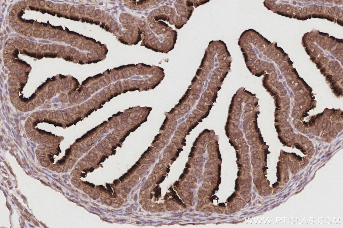Immunohistochemistry (IHC) staining of mouse ovary tissue using UNC45A Polyclonal antibody (19564-1-AP)