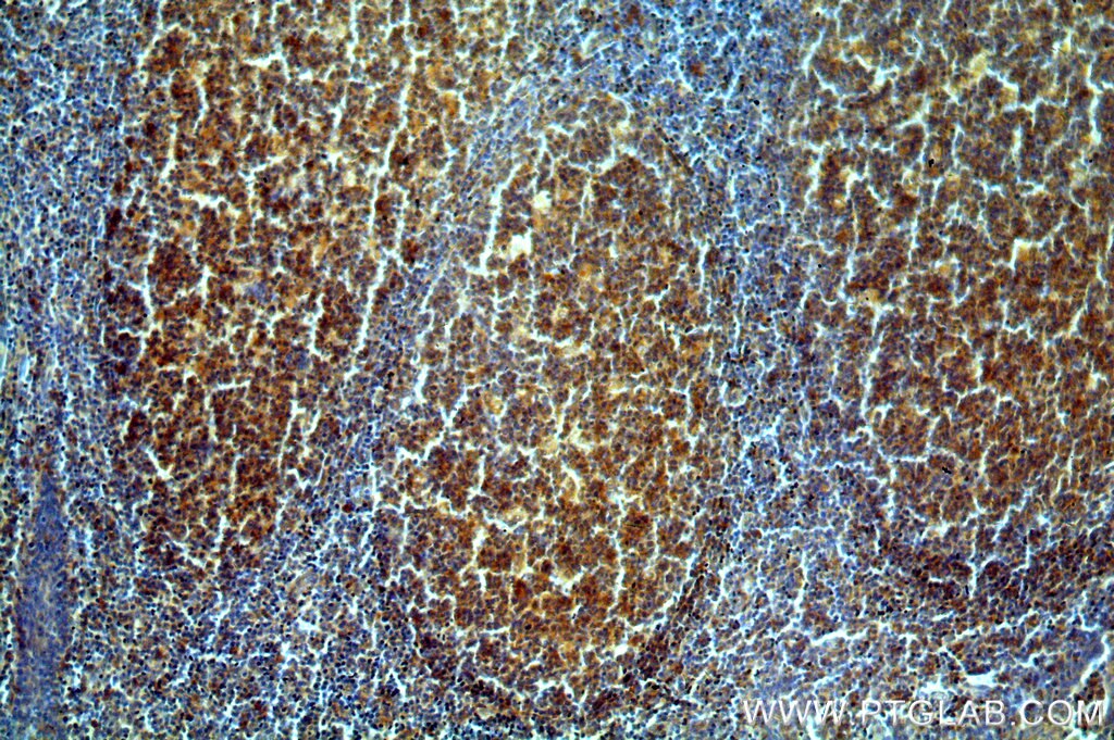 Immunohistochemistry (IHC) staining of human tonsil tissue using UNC45A Polyclonal antibody (19564-1-AP)