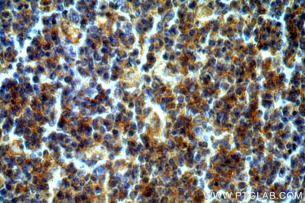 Immunohistochemistry (IHC) staining of human tonsil tissue using UNC45A Polyclonal antibody (19564-1-AP)