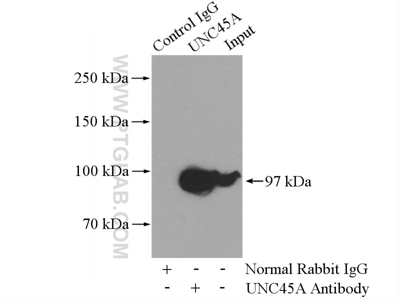 Immunoprecipitation (IP) experiment of K-562 cells using UNC45A Polyclonal antibody (19564-1-AP)