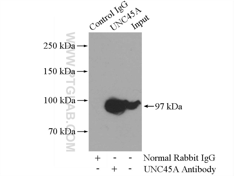 IP experiment of K-562 using 19564-1-AP