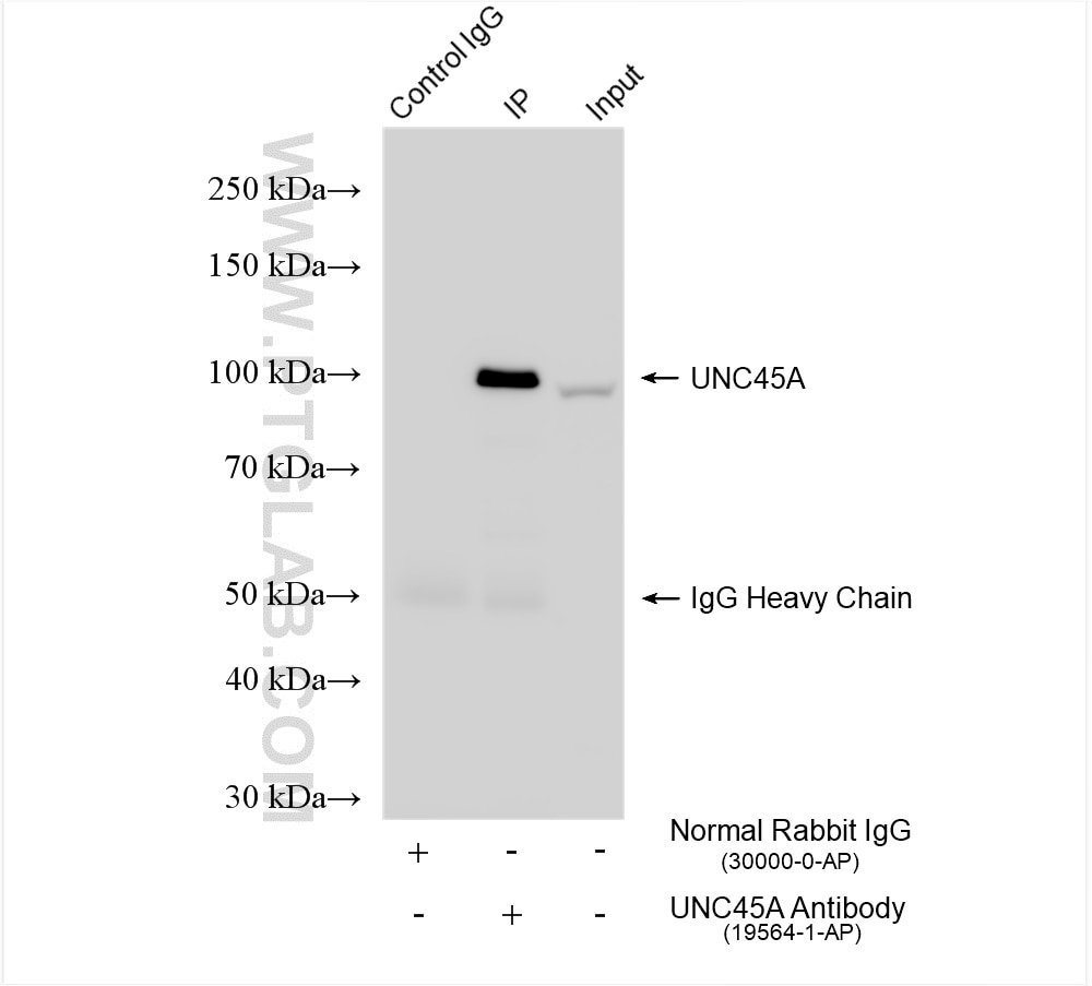 Immunoprecipitation (IP) experiment of K-562 cells using UNC45A Polyclonal antibody (19564-1-AP)