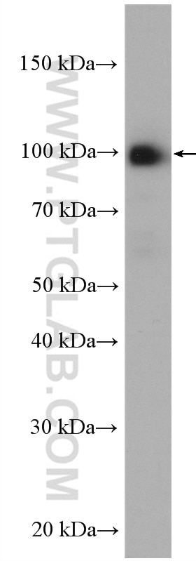 Western Blot (WB) analysis of K-562 cells using UNC45A Polyclonal antibody (19564-1-AP)