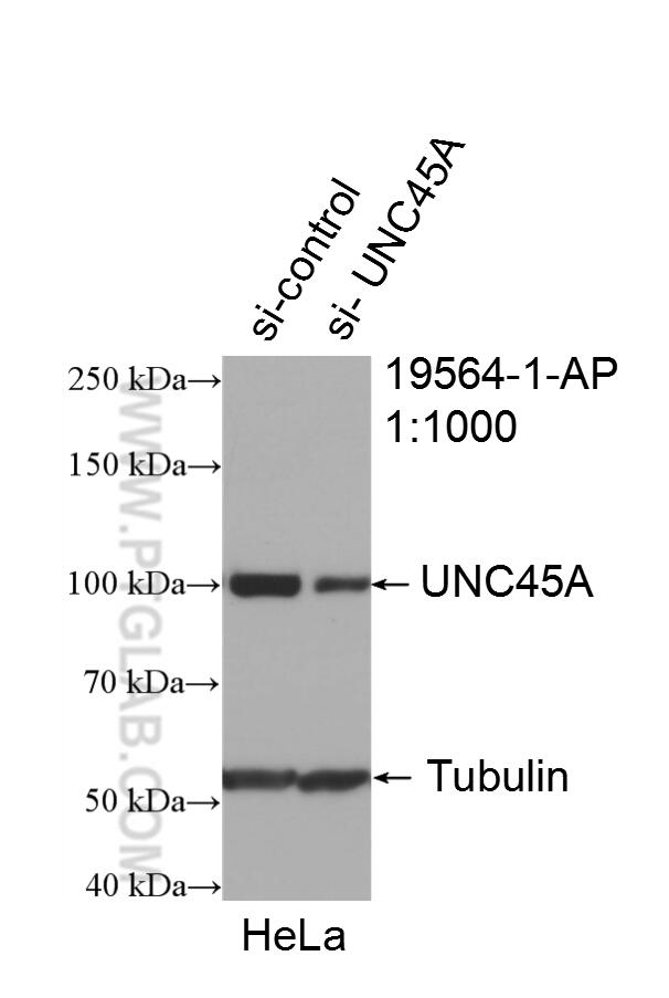 Western Blot (WB) analysis of HeLa cells using UNC45A Polyclonal antibody (19564-1-AP)
