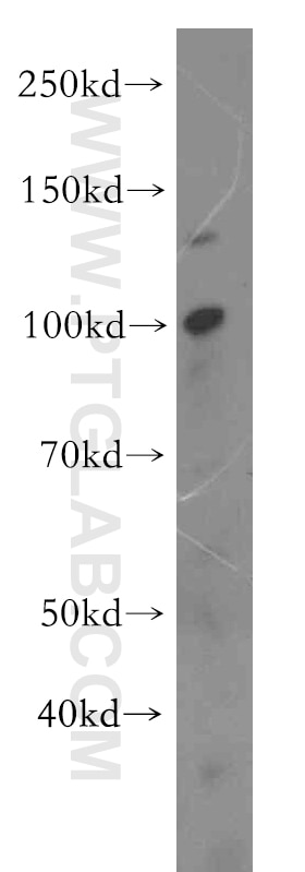 Western Blot (WB) analysis of mouse lung tissue using UNC45A Polyclonal antibody (19564-1-AP)