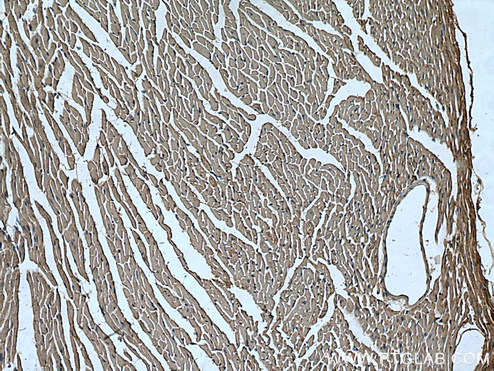 Immunohistochemistry (IHC) staining of mouse heart tissue using UNC45B Polyclonal antibody (21640-1-AP)