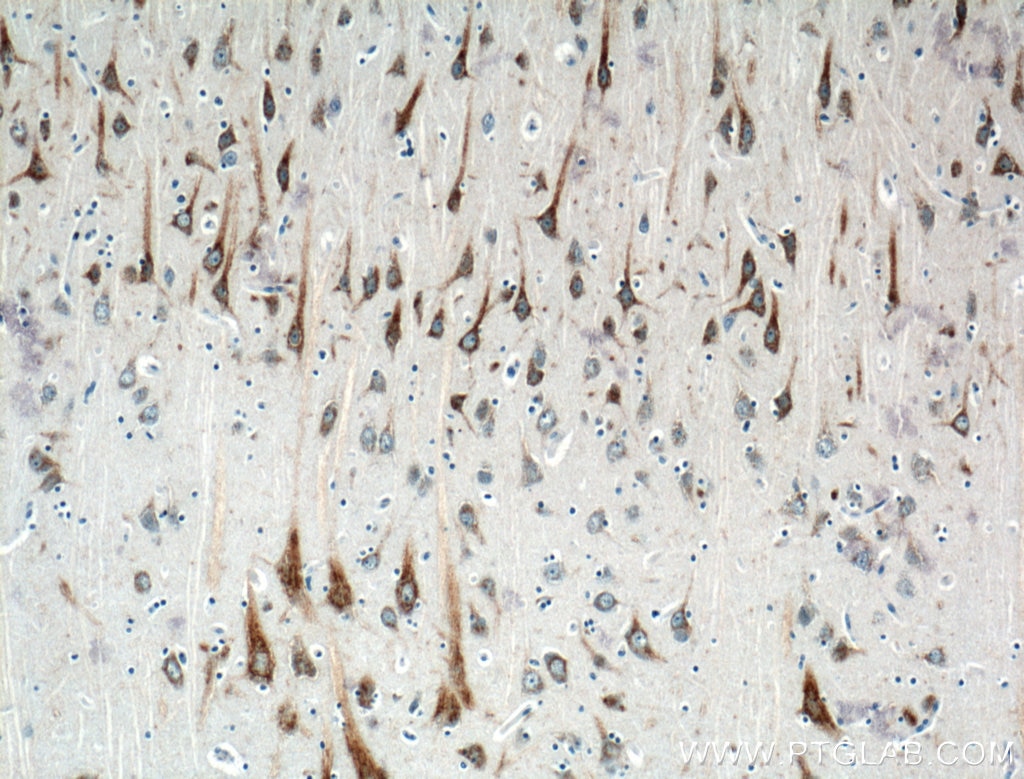 Immunohistochemistry (IHC) staining of human brain tissue using UNC5A Polyclonal antibody (22068-1-AP)