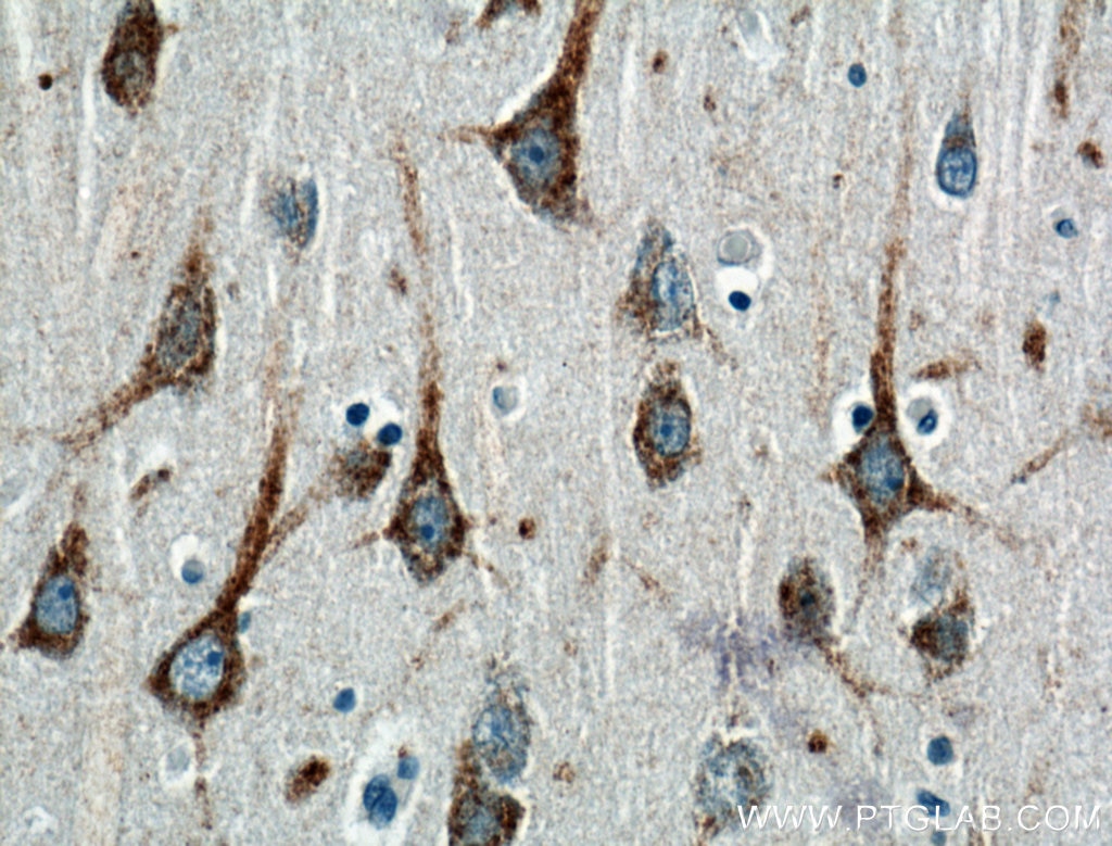 Immunohistochemistry (IHC) staining of human brain tissue using UNC5A Polyclonal antibody (22068-1-AP)