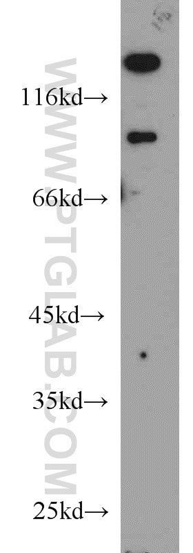 Western Blot (WB) analysis of MCF-7 cells using UNC5A Polyclonal antibody (22068-1-AP)