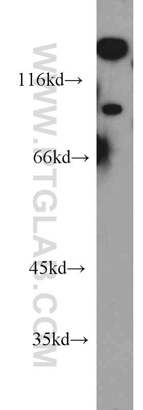 Western Blot (WB) analysis of PC-3 cells using UNC5A Polyclonal antibody (22068-1-AP)