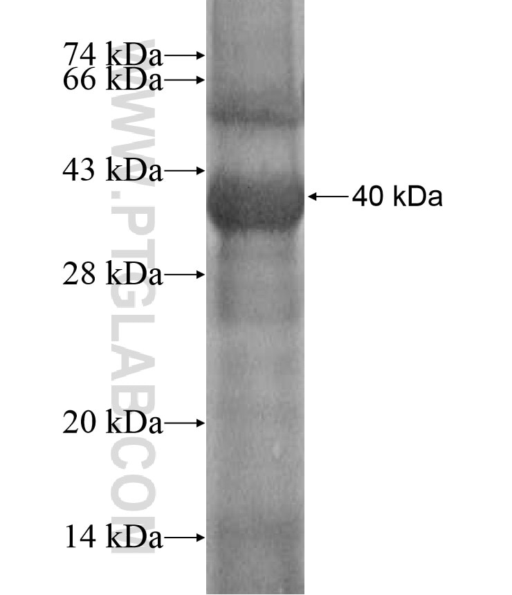 UNC5A fusion protein Ag17155 SDS-PAGE