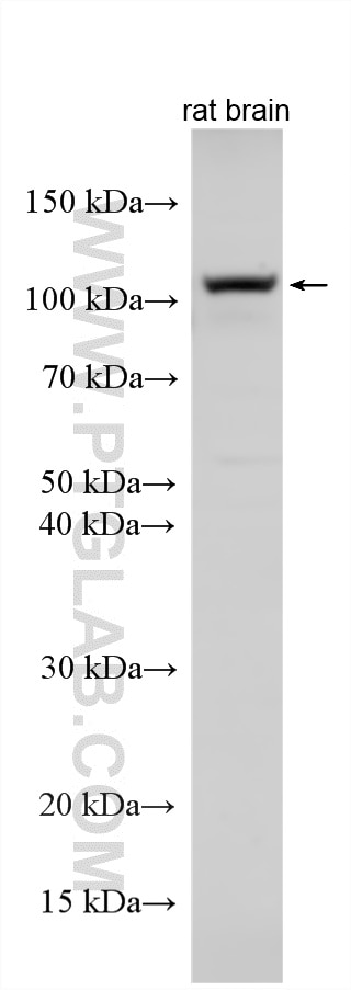Western Blot (WB) analysis of various lysates using UNC5A-Specific Polyclonal antibody (20239-1-AP)