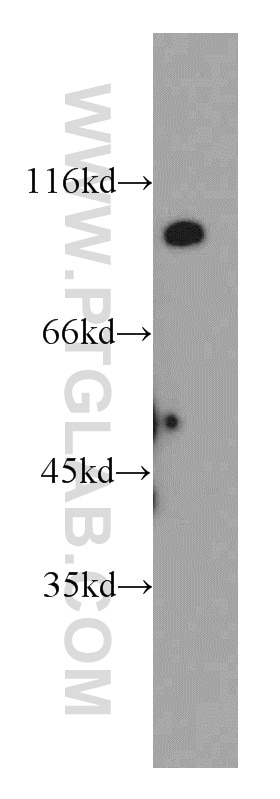 Western Blot (WB) analysis of mouse brain tissue using UNC5A-Specific Polyclonal antibody (20239-1-AP)