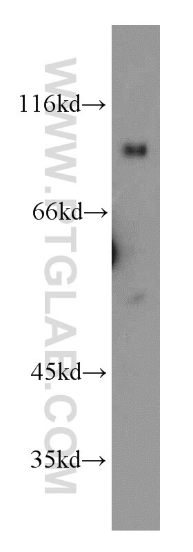 Western Blot (WB) analysis of mouse brain tissue using UNC5A-Specific Polyclonal antibody (20239-1-AP)