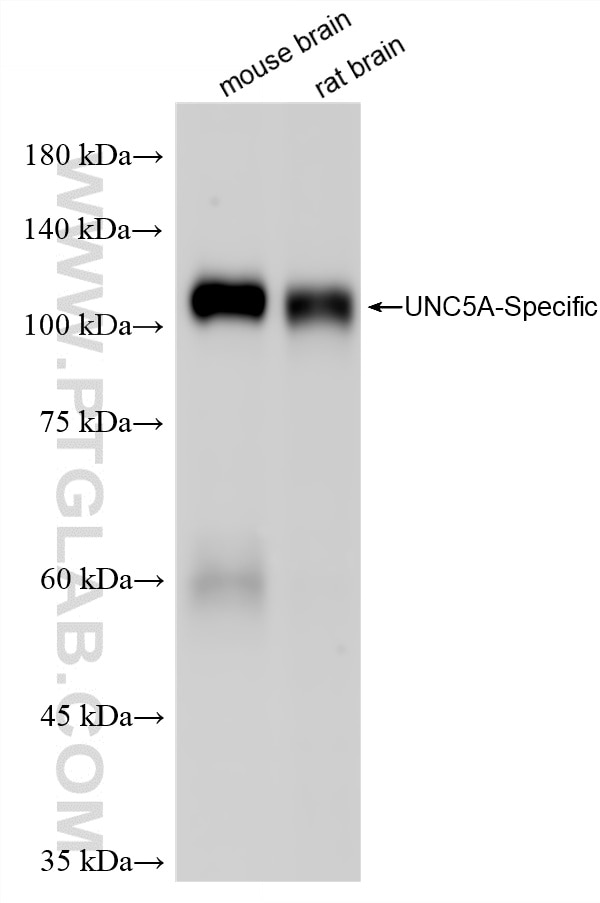 Various lysates were subjected to SDS PAGE followed by western blot with 86582-1-RR (UNC5A-Specific antibody) at dilution of 1:2000 incubated at room temperature for 1.5 hours. Western Blot (WB) analysis of various lysates using UNC5A-Specific Recombinant antibody (86582-1-RR)