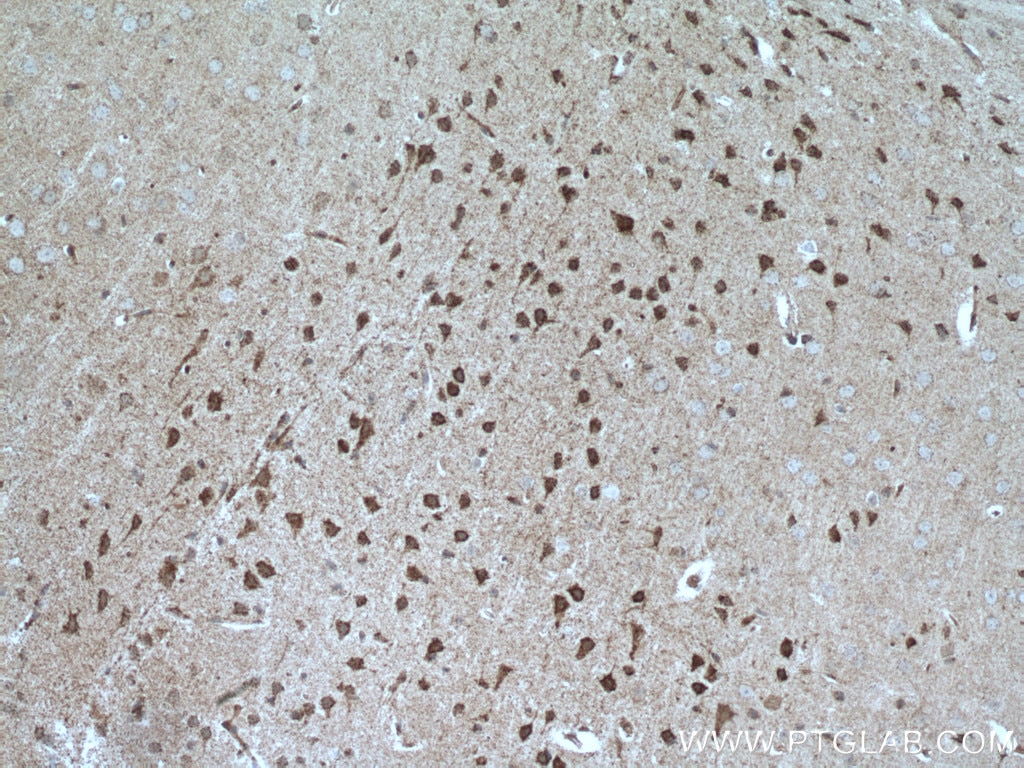 Immunohistochemistry (IHC) staining of mouse brain tissue using UNC5C-Specific Polyclonal antibody (20240-1-AP)