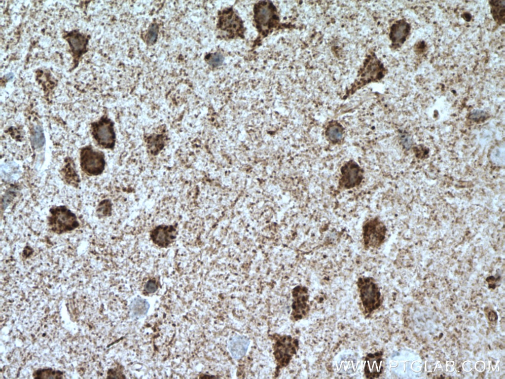 Immunohistochemistry (IHC) staining of mouse brain tissue using UNC5C-Specific Polyclonal antibody (20240-1-AP)