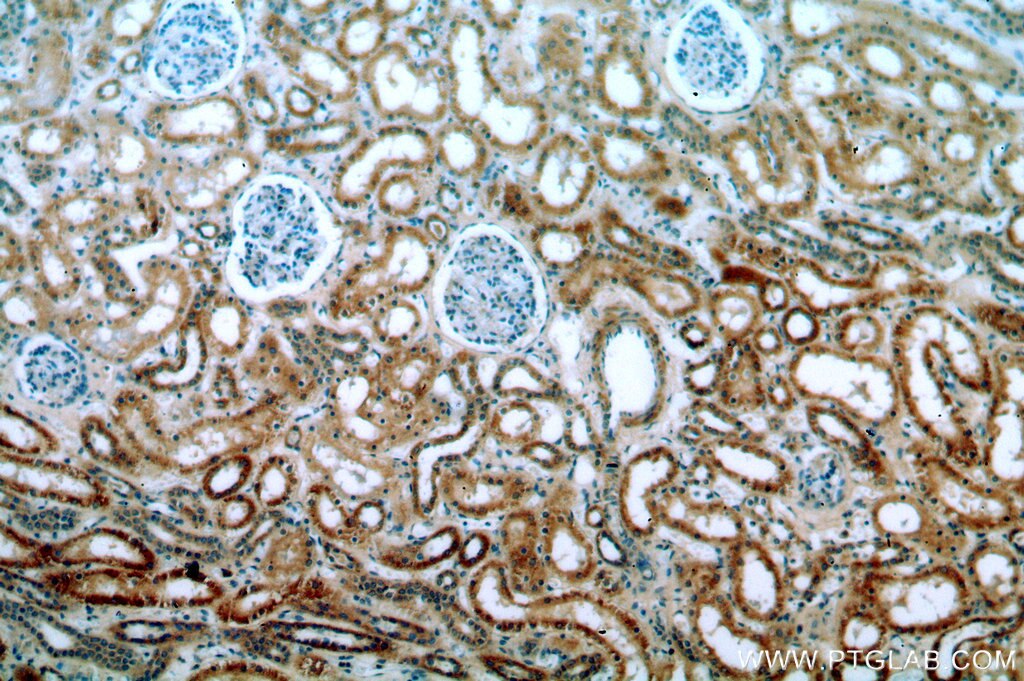 UNC5C-Specific