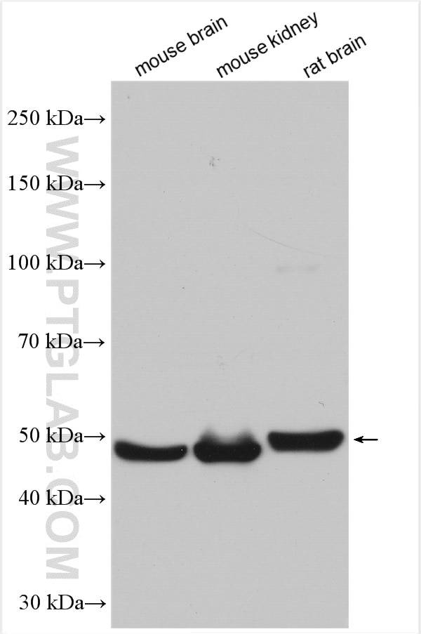 Western Blot (WB) analysis of various lysates using UNC5C-Specific Polyclonal antibody (20240-1-AP)