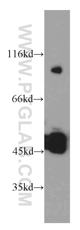 Western Blot (WB) analysis of mouse brain tissue using UNC5C-Specific Polyclonal antibody (20240-1-AP)