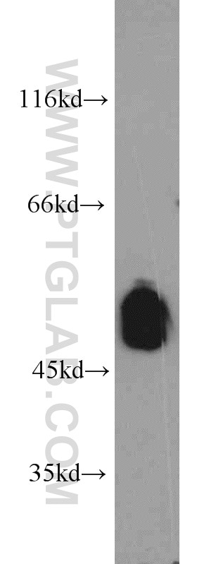 Western Blot (WB) analysis of mouse brain tissue using UNC5C-Specific Polyclonal antibody (20240-1-AP)