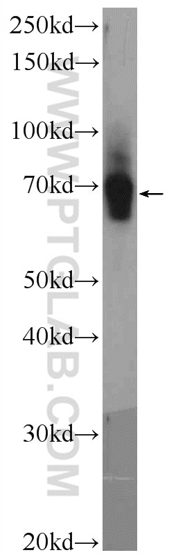 Western Blot (WB) analysis of mouse colon tissue using UNC5CL Polyclonal antibody (13322-1-AP)