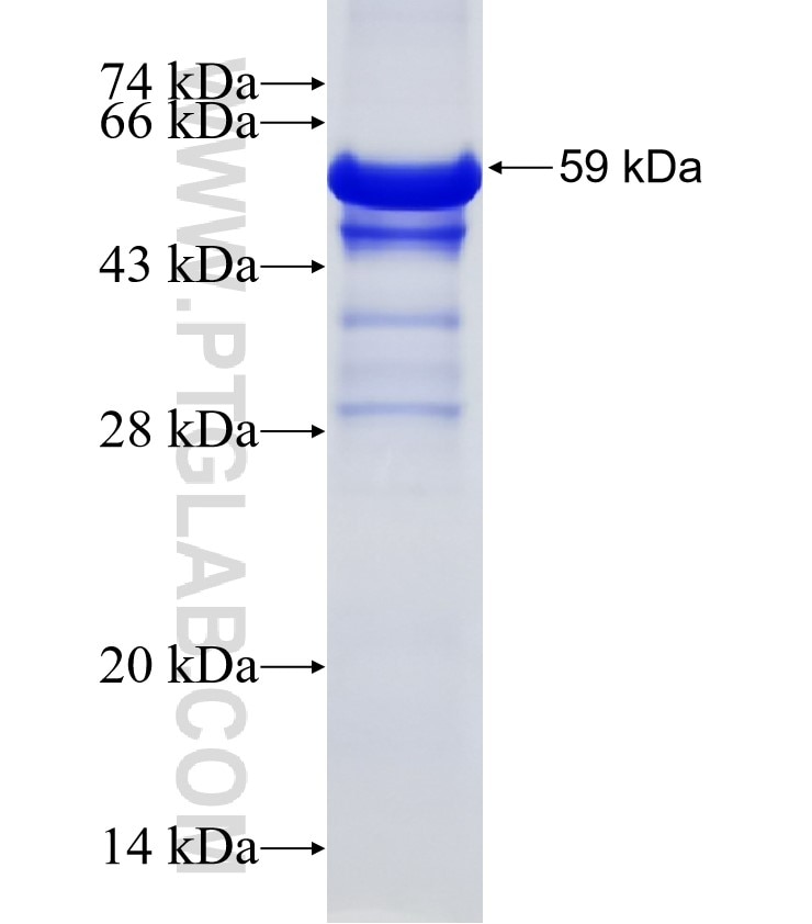 UNC5CL fusion protein Ag3970 SDS-PAGE