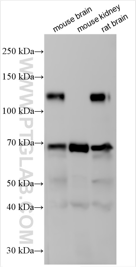 Western Blot (WB) analysis of various lysates using UNC5D Polyclonal antibody (29941-1-AP)