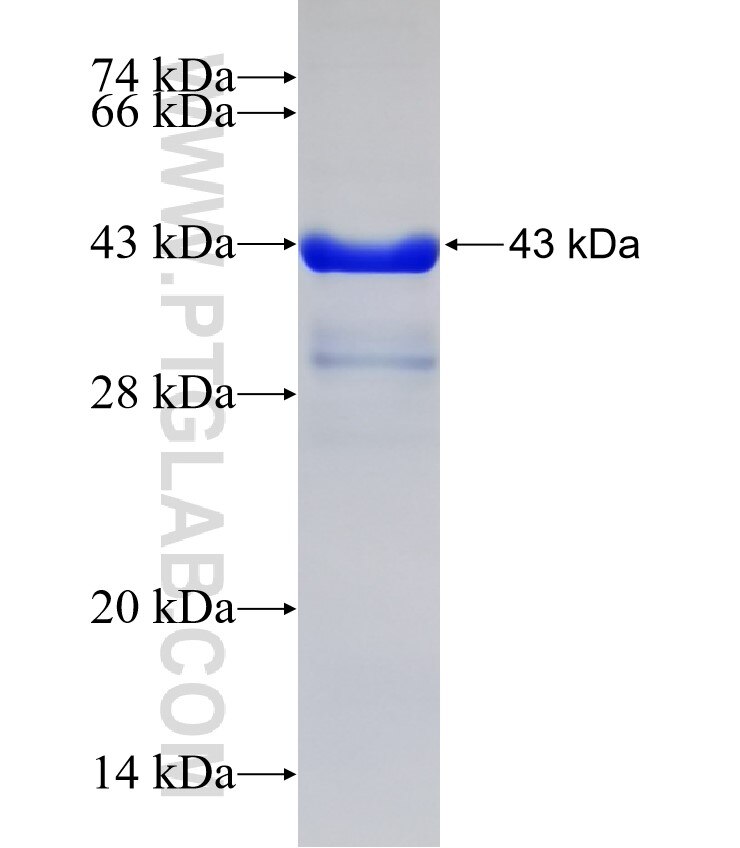 UNC5D fusion protein Ag31973 SDS-PAGE