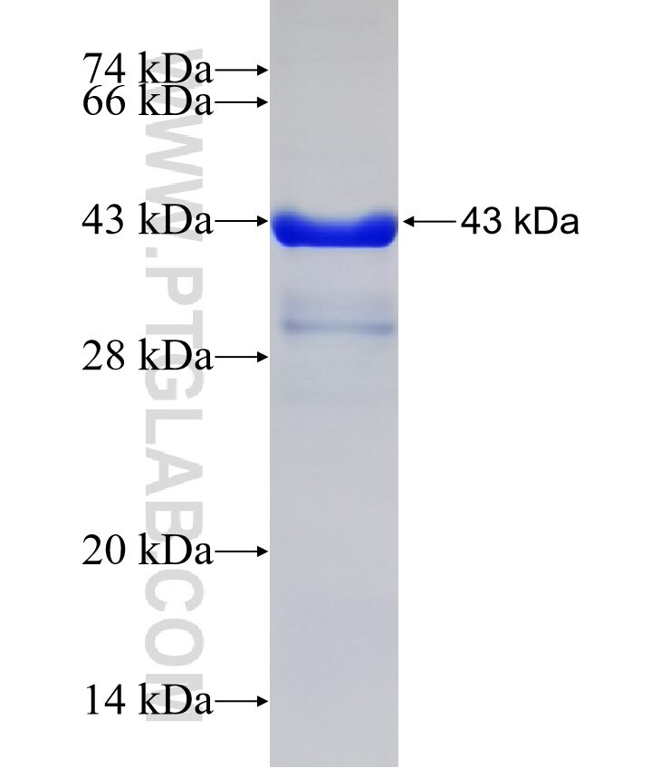 UNC5D fusion protein Ag31973 SDS-PAGE