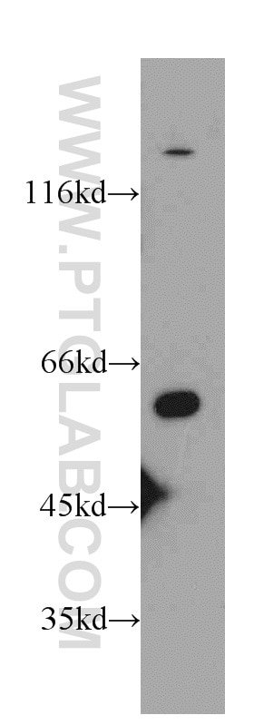 Western Blot (WB) analysis of mouse kidney tissue using UNC5D-Specific Polyclonal antibody (20241-1-AP)